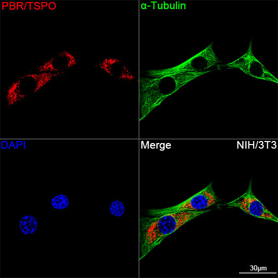 TSPO Antibody in Immunocytochemistry (ICC/IF)