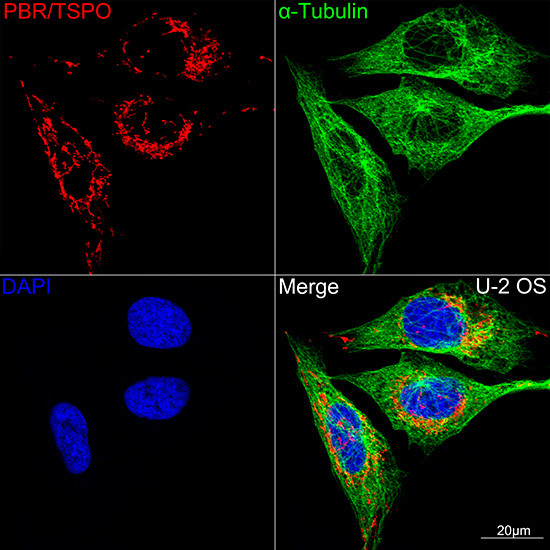 TSPO Antibody in Immunocytochemistry (ICC/IF)