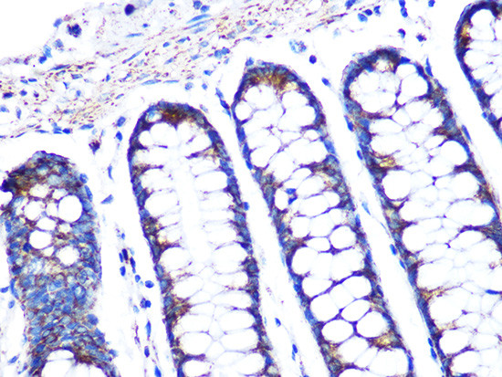 TSPO Antibody in Immunohistochemistry (Paraffin) (IHC (P))