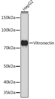 Vitronectin Antibody in Western Blot (WB)