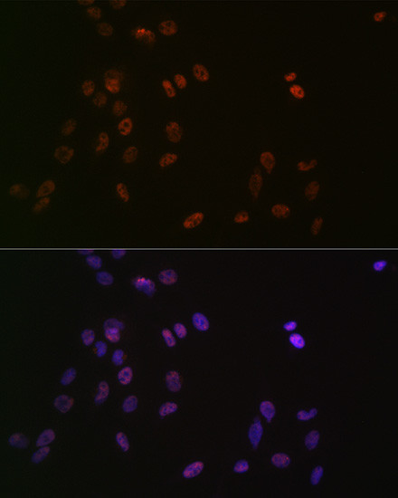 ASH2L Antibody in Immunocytochemistry (ICC/IF)