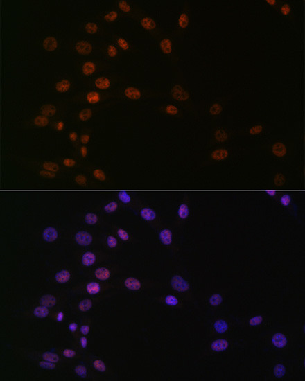 ASH2L Antibody in Immunocytochemistry (ICC/IF)