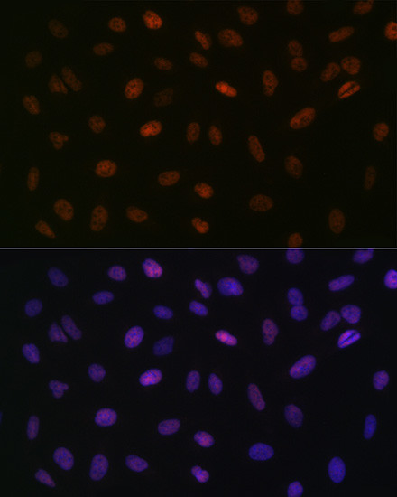 ASH2L Antibody in Immunocytochemistry (ICC/IF)