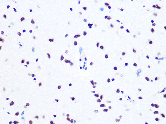 ASH2L Antibody in Immunohistochemistry (Paraffin) (IHC (P))