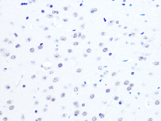 ASH2L Antibody in Immunohistochemistry (Paraffin) (IHC (P))