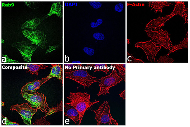 RAB9 Antibody in Immunocytochemistry (ICC/IF)