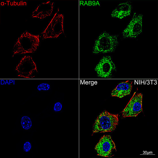 RAB9 Antibody in Immunocytochemistry (ICC/IF)