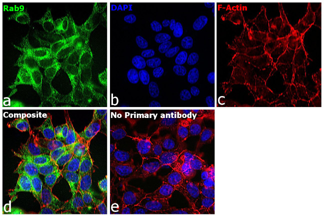 RAB9 Antibody in Immunocytochemistry (ICC/IF)