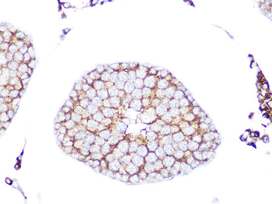 RAB9 Antibody in Immunohistochemistry (Paraffin) (IHC (P))