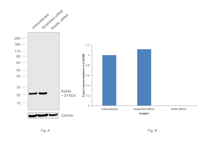 RAB9 Antibody