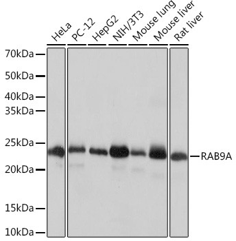 RAB9 Antibody in Western Blot (WB)