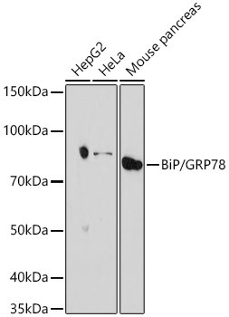 GRP78 Antibody in Western Blot (WB)