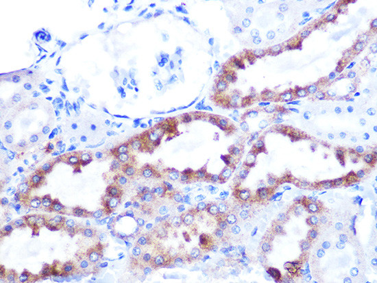 Cytochrome C Antibody in Immunohistochemistry (Paraffin) (IHC (P))