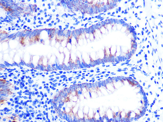 Cytochrome C Antibody in Immunohistochemistry (Paraffin) (IHC (P))