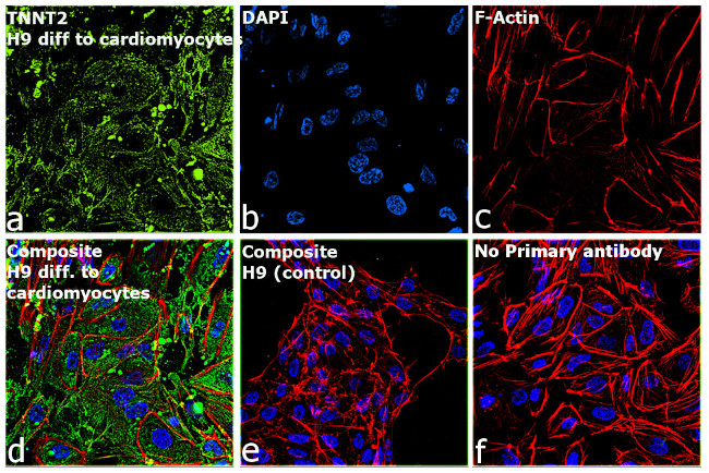 Cardiac Troponin T Antibody in Immunocytochemistry (ICC/IF)