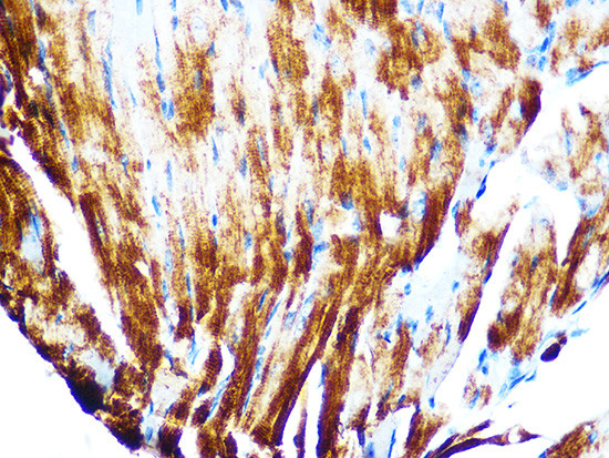 Cardiac Troponin T Antibody in Immunohistochemistry (Paraffin) (IHC (P))