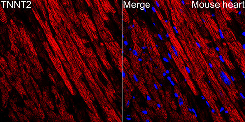 Cardiac Troponin T Antibody in Immunohistochemistry (Paraffin) (IHC (P))