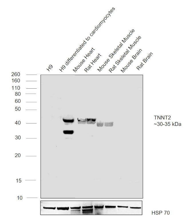 Cardiac Troponin T Antibody