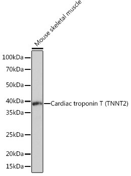 Cardiac Troponin T Antibody in Western Blot (WB)