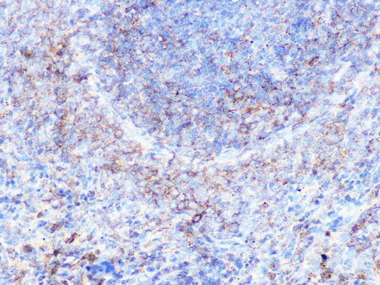 Moesin Antibody in Immunohistochemistry (Paraffin) (IHC (P))