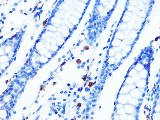 Moesin Antibody in Immunohistochemistry (Paraffin) (IHC (P))