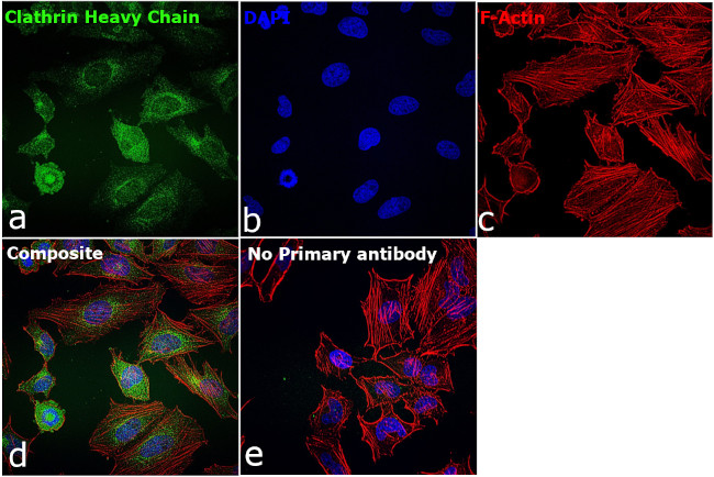 Clathrin Heavy Chain Antibody in Immunocytochemistry (ICC/IF)