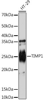 TIMP1 Antibody in Western Blot (WB)