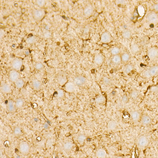 PI3K p85 alpha Antibody in Immunohistochemistry (Paraffin) (IHC (P))