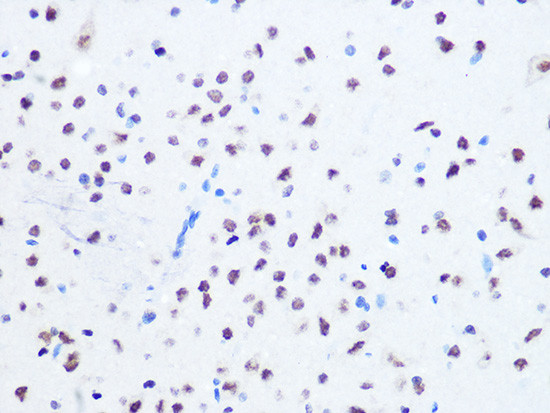 OGG1 Antibody in Immunohistochemistry (Paraffin) (IHC (P))