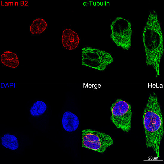 Lamin B2 Antibody in Immunocytochemistry (ICC/IF)