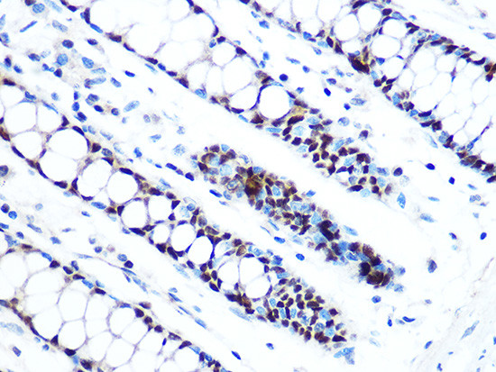 MCM5 Antibody in Immunohistochemistry (Paraffin) (IHC (P))