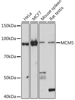 MCM5 Antibody in Western Blot (WB)