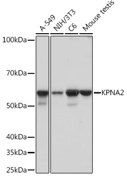 KPNA2 Antibody in Western Blot (WB)