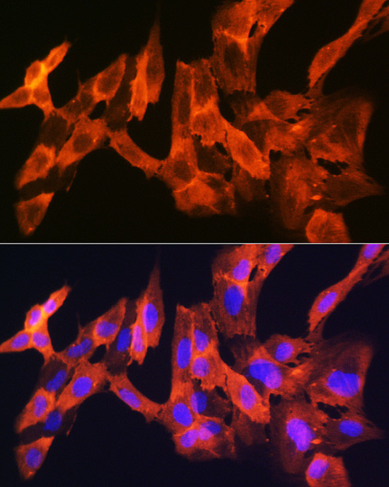 JNK1/JNK3 Antibody in Immunocytochemistry (ICC/IF)