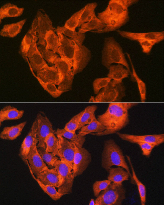 JNK1/JNK3 Antibody in Immunocytochemistry (ICC/IF)