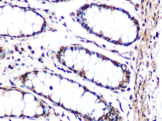 JNK1/JNK3 Antibody in Immunohistochemistry (Paraffin) (IHC (P))