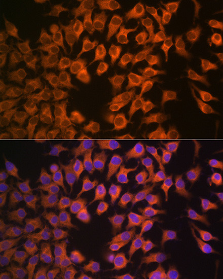 CYP17A1 Antibody in Immunocytochemistry (ICC/IF)