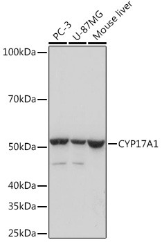 CYP17A1 Antibody in Western Blot (WB)