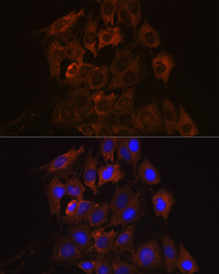 UPF1 Antibody in Immunocytochemistry (ICC/IF)