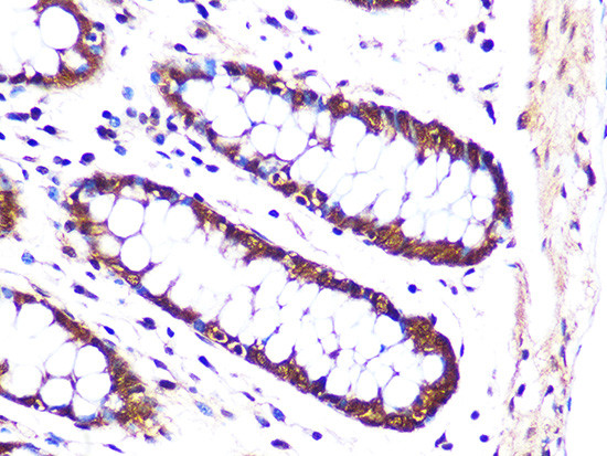 PSMA3 Antibody in Immunohistochemistry (Paraffin) (IHC (P))