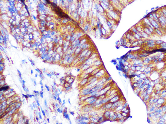 PAR2 Antibody in Immunohistochemistry (Paraffin) (IHC (P))