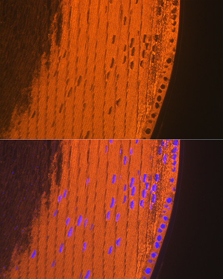 Alpha A Crystallin Antibody in Immunohistochemistry (Paraffin) (IHC (P))