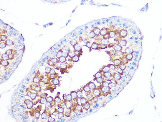 EBP1 Antibody in Immunohistochemistry (Paraffin) (IHC (P))