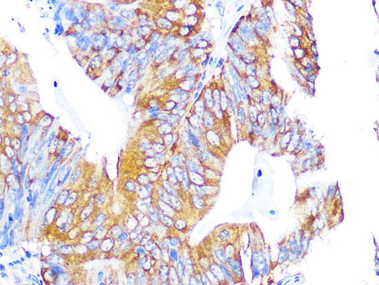 EBP1 Antibody in Immunohistochemistry (Paraffin) (IHC (P))