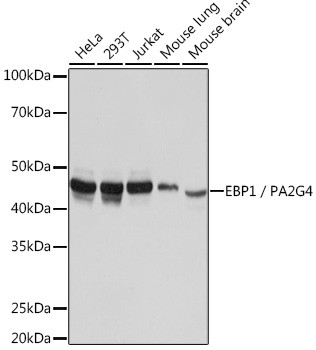 EBP1 Antibody in Western Blot (WB)