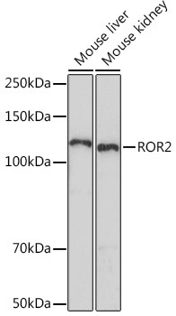 ROR2 Antibody in Western Blot (WB)