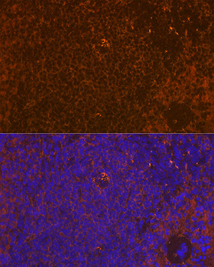 WASP Antibody in Immunohistochemistry (Paraffin) (IHC (P))