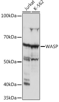 WASP Antibody in Western Blot (WB)