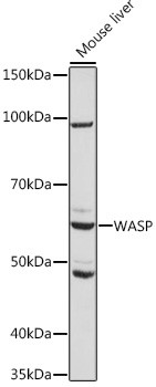 WASP Antibody in Western Blot (WB)