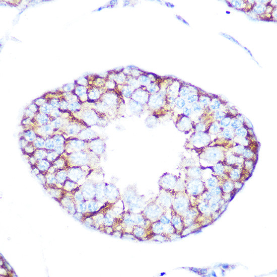 CHRM2 Antibody in Immunohistochemistry (Paraffin) (IHC (P))